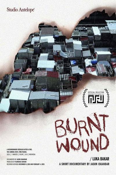 Burnt Wound